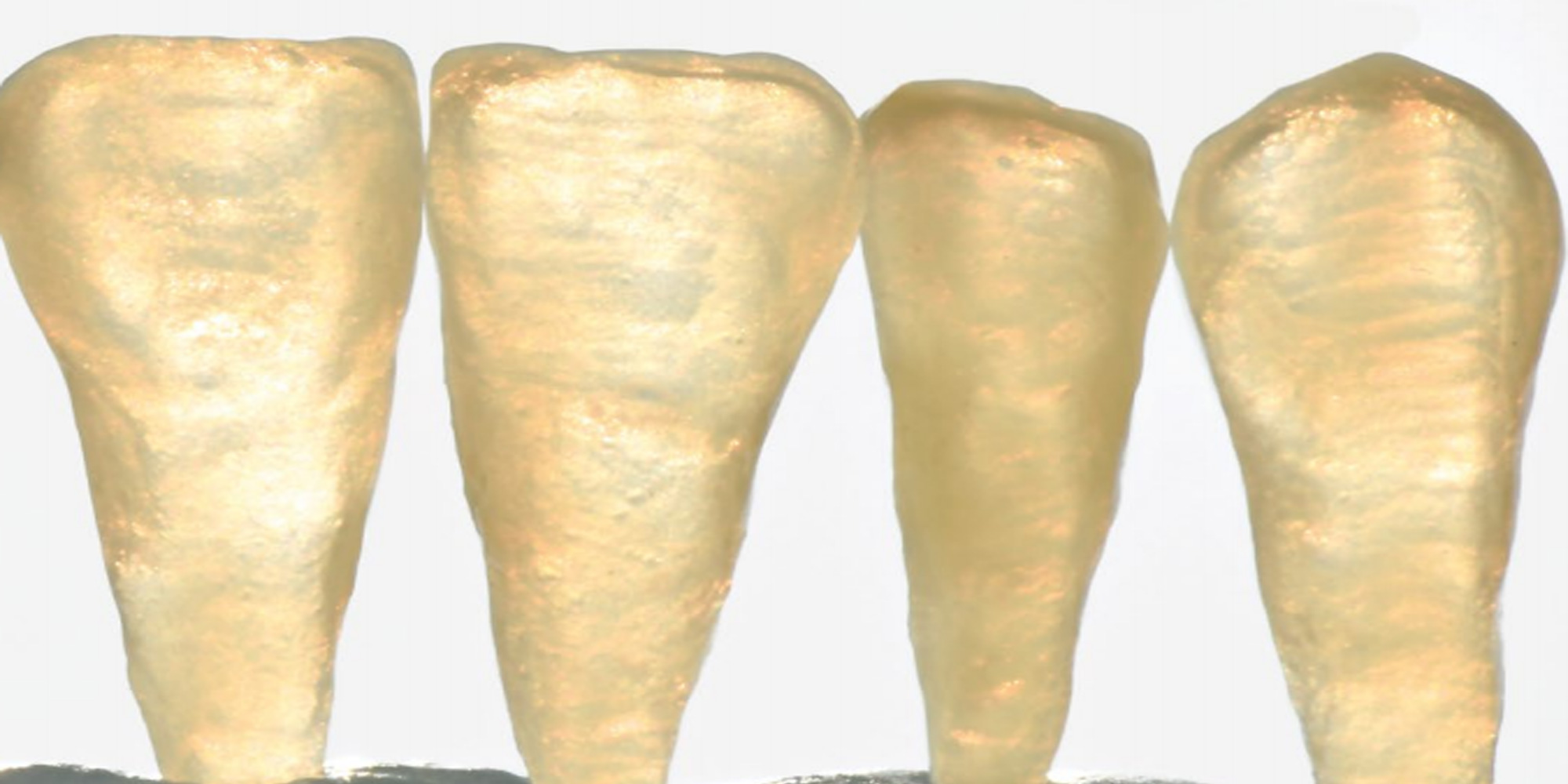 CELTRA – Zirconia Reinforced Lithium Silicate images