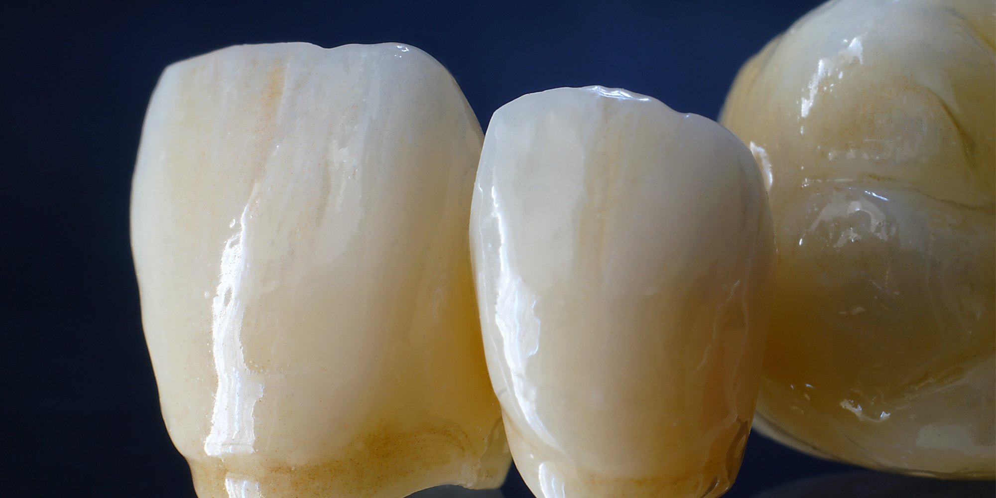 Monolithic Zirconia image